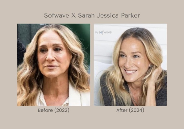 Sarah Jessica Parker en sofwave